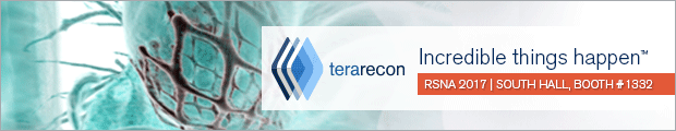 Terarecon