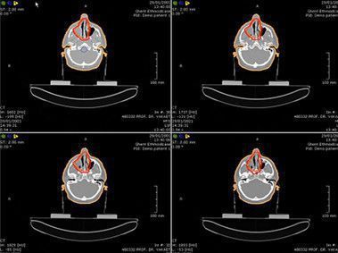 Data management software / viewing / for radiation therapy Suitestensa RT ESAOTE