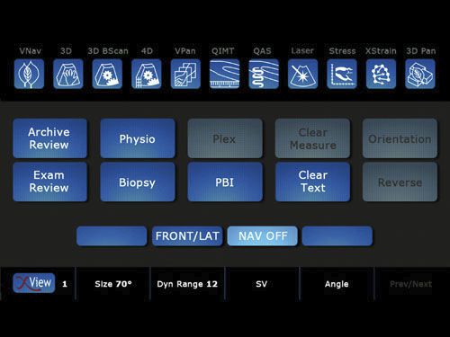 Ultrasound system / on platform / for multipurpose ultrasound imaging MyLab™ClassC ESAOTE